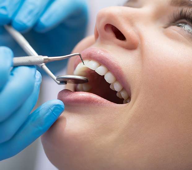 Issaquah Dental Bonding