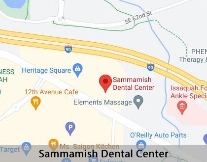 Map image for Dental Anxiety in Issaquah, WA
