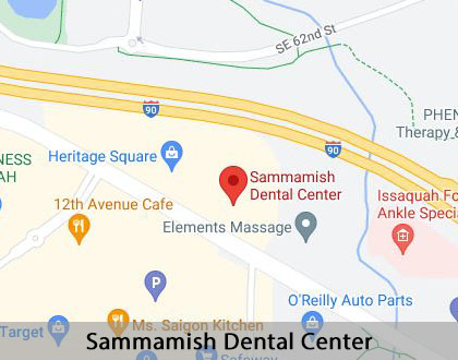 Map image for Options for Replacing Missing Teeth in Issaquah, WA