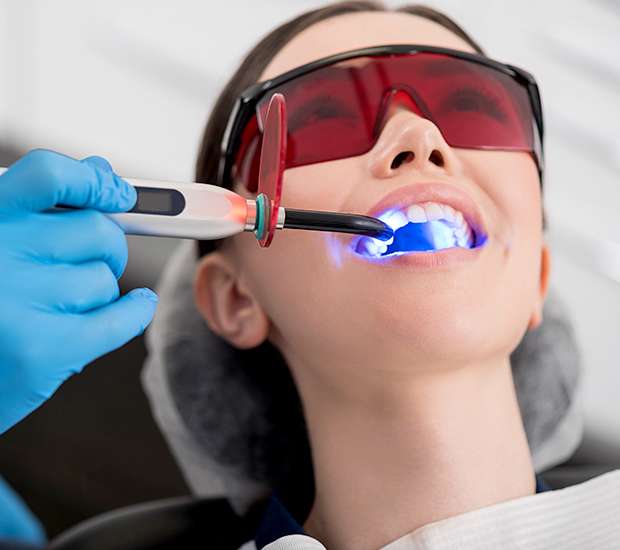Issaquah Professional Teeth Whitening